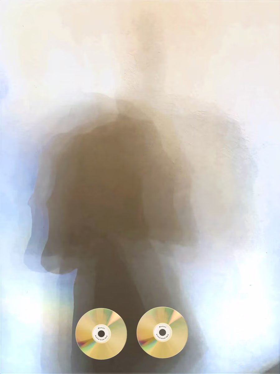Shadow Profile with Discs