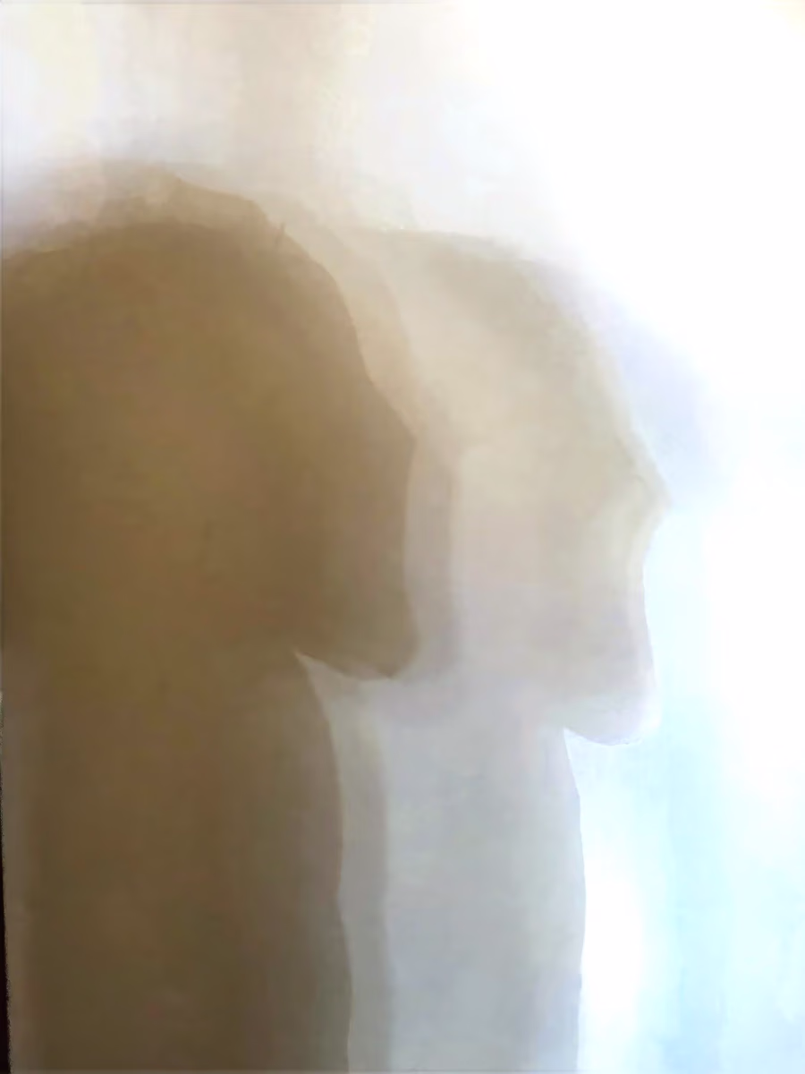 Dual Profile Silhouette